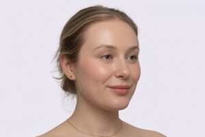 A woman with glowing, clear skin after a professional face skin treatment at Clara MedSpa in Thornhill.