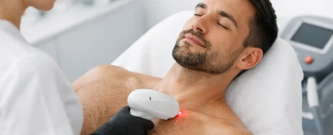 Laser Hair Removal for Men: What to Expect