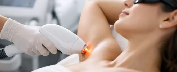 How Laser Hair Removal Works
