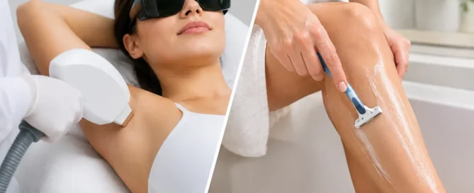 Laser Hair Removal vs Shaving for Smooth Skin
